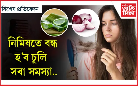 প্ৰতিদিনে এমুঠি চুলি সৰে নেকি? 